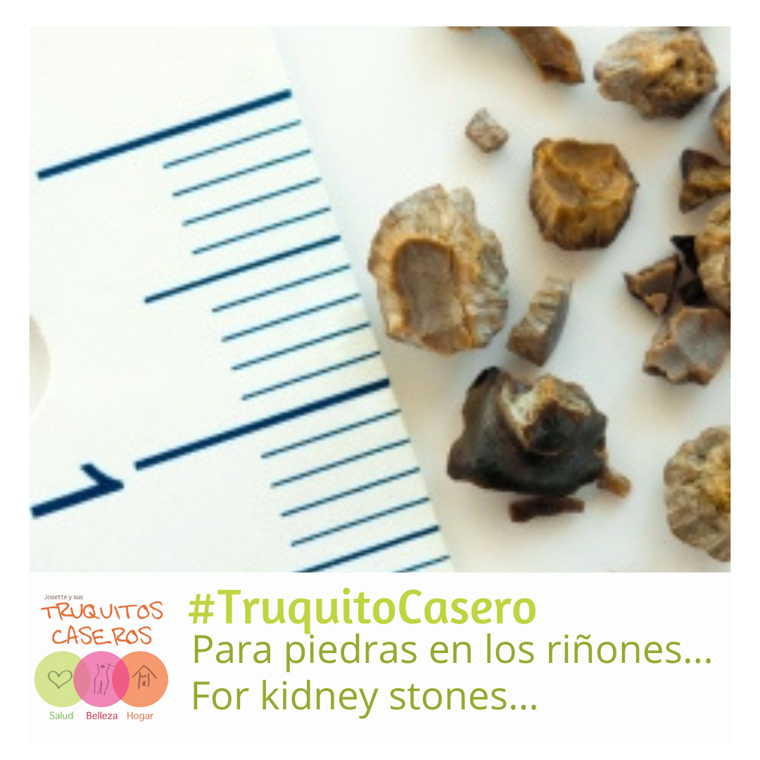 Truquito Casero para piedras en el riñón...